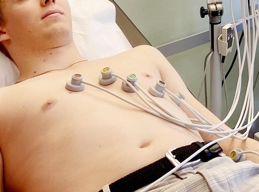 Ruhe-EKG